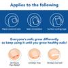 120pcs Ingrown Toenail Treatment, Breathable Ingrown Toenail Strips IngrownToenail Stickers, Toenail Corrector Patch with 5 Pedicure Tools for Ingrown Toenail view 3