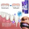 Dental Treatment Toothpaste, 100g Natural Teeth Whitening Toothpaste for Men and Women (1PCS) view 2