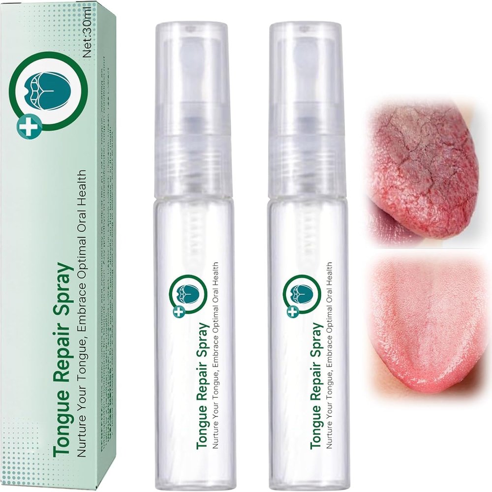 Tongue Repair Spray,Oral Antibacterial Spray for Instant Dry Mouth Relief, White Coating& Bad Breath,Fissured Tongue-Relief&Mint Breath Freshener,Gentle Daily Tongue Repair30ml (2PCS)