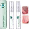 Tongue Repair Spray,Oral Antibacterial Spray for Instant Dry Mouth Relief, White Coating& Bad Breath,Fissured Tongue-Relief&Mint Breath Freshener,Gentle Daily Tongue Repair30ml (2PCS) view 1
