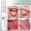 Tongue Repair Spray,Oral Antibacterial Spray for Instant Dry Mouth Relief, White Coating& Bad Breath,Fissured Tongue-Relief&Mint Breath Freshener,Gentle Daily Tongue Repair30ml (2PCS) view 4