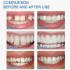 Temporary Tooth Repair Kit, 30ml Dental Filling for Cracked & Chipped Teeth, Quick Restoration & Shaping for Adults, Easy At-Home Use view 4