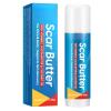 Scar Repair Stick, Butter Blend, 20g, Burn Cream, Scar Tissue Removal Skin Cream, Lightweight Hydration, Or Men Women Body Hand Leg Knee Neck Burn Pimple view 1