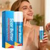 Scar Repair Stick, Butter Blend, 20g, Burn Cream, Scar Tissue Removal Skin Cream, Lightweight Hydration, Or Men Women Body Hand Leg Knee Neck Burn Pimple view 4