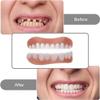 Dentures Full Mouth Dentures False Teeth Set for Adults Soft And Comfortable Upper And Lower Denture Sets for Men And Women Natural Looking Teeth,9 pairs view 3