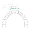 16PCS,Compatible for PhilipsReplacement Toothbrush Heads Sonic Electric(HX3226-16pcs) view 3