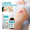 Skin Liquid Waterproof Plaster,Liquid Skin Glue for Wounds Human, Wound Dressing,Breathable Transparent Skin Glue for Wound,Quick Dry Gel (1PCS) view 2