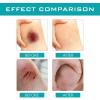 Skin Liquid Waterproof Plaster,Liquid Skin Glue for Wounds Human, Wound Dressing,Breathable Transparent Skin Glue for Wound,Quick Dry Gel (1PCS) view 4
