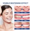 10% Nano Hydroxyapatite Toothpaste - Fluoride-Free, Enamel Repair & Remineralizing, Whitening & Cavity Protection for Sensitive Teeth, Fresh Mint Flavor,120g (3pcs) view 3