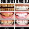 Propolis Oral Health Spray, Propolis Oral Spray,Deep Cleaning, Clean Teeth Stains,Clean Teeth Stains and Tartar (2) view 3