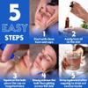 4 PCS Facial Cupping Set | Silicone Vacuum Suction | Cupping Massage Therapy | A Kit for Anti Cellulite, Anti Wrinkle and Instantly Ageless Skin | for Eyes, Face and Body view 4