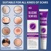 Silicone Scar Gel, Advanced Medical Grade Scar Silicone Cream for Old & New Scars, Surgical Scars, Acne, Burn, Keloids & Stretch Marks 30g view 3