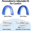 Anti Snoring Device, Mandibular Advancement, Airway Opening, Adjustable Fit, Reusable, Comfortable, For Adults view 3