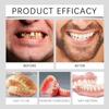 Cvioert Dentures, Cvioert Premium Dentures, Silicone Dentures To Fit Over Existing Teeth, Snap On Veneers Teeth, Premium Dentures Full Set For Men And Women (1pcs) view 3