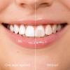Tooth Polish, Tooth Paint, Teeth Whitening Paint, Instant Teeth Stain Removal, Brighting and Polish Teeth in Minutes, Gentle Formula, Easy to Use (2PC) view 2