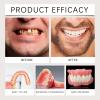 Cosmetic Teeth Veneers - Temporary Teeth Covers - Cosmetic Clip On Teeth for Beautiful Smile - Clip On Veneers for Smile Enhancement, Reusable Cosmetic Teeth, Easy to Wear & Remove (3 Boxes) view 3