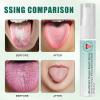 2PCS Tongue Repair Spray,Instant Dry Mouth Spray,Fissured Tongue Relief,Breath Freshening Mist,Long-Lasting Hydrating,30ML view 4