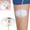 6 Pcs Adhesive Catheter Stabilization Device Adhesive Catheter Leg Bag Holder Stickers for Urinary Tubes Secure Catheter Supplies for Single Or Double Tube Use view 3