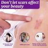 Silicone Scar Gel - Advanced Treatment for Old & New Scars, C-Section, Surgery, Stretch Marks - Smooth, Fade & Repair Skin Scar Removal Cream view 3