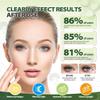 Eye Vitamins, Vision Support, Eye Health for Adults & Seniors Support, Vitamins C/E view 4
