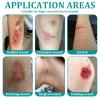 10 Pcs Silicone Foam Dressing, 55cm Waterproof Silicone Dressings for Wounds, Absorbent Breathable Padded Foam Dressing for Wound Care view 4