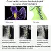 Air-Powered Neck Traction Device for Neck Strain Relief, Adjustable and Lightweight Design view 3