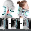 Adjustable Electric Neck Traction Device for Pain Relief and Cervical Spine Support view 2