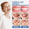 Benaewa 2-Pack Tooth Filling Repair Kit, Dentite Tooth Amour for Gum Treatment, Cavity Repair & Stain Removal view 2