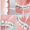 Interdental Brushes for Braces, 100 Count, 4 Colors, Soft Bristles, Dental Floss Picks for Oral Cleaning view 2