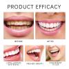 Instant Whitening Tooth Paint,Whitening Toothpaste Sensitive Teeth,Tooth Polish,Teeth Whitening Mouthwash,Simple & Portable Paint for Teeth,Stain Removal and Freshen Breath (2pcs) view 4