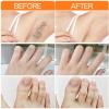 Joy Pretty Facial Hair Remover, Simmple Joypretty Cream, Womens Facial Hair Remover for Body Face Lips (3PCS) view 4
