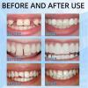 20ml Dental Glue & Moldable False Teeth,Temporary Tooth Repair Kit,Filling Kit for Missing Broken Teeth,Fixing Missing Gaps,Strong Adhesion,Easy to Operate,Convenient,Included a Pair of Tweezers view 2