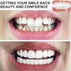 Dentures Cosmetic Dentaduras Temporales Veneers White Dentures for Women Men Comfortable Protect Your Teeth and Regain Confident Smile,25 Pairs view 2