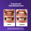 Dent Teeth Whitening Strips, Purple Whitening Strips Help Reduce Surface Stains, Easy Daily Oral Care Whitening Treatment for Adults Bright Smile Dental Care (2 Box) view 4