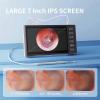Digital Otoscope with 3.9mm Camera, 6 LED Lights, 7-Inch IPS Screen for Ear Wax Removal for Adults, Kids, and Pets view 3