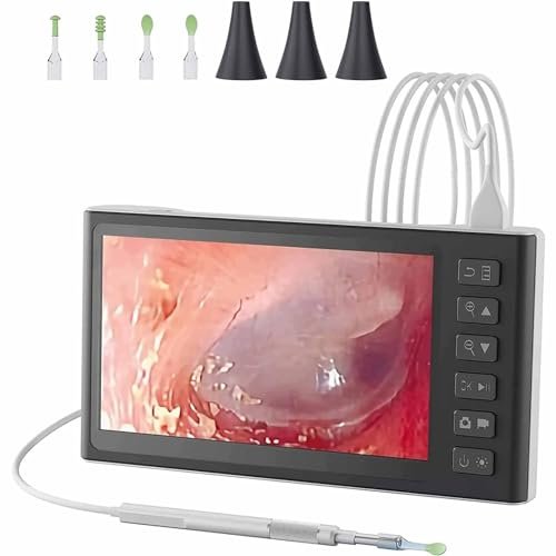 A digital otoscope with a camera, LED light, and PS screen, suitable for earwax removal in adults and pets.