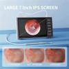A digital otoscope with a camera, LED light, and PS screen, suitable for earwax removal in adults and pets. view 2