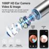 10MP HD Ear Cleaner with Camera, Ear Wax Removal Tool with LED Light, Wireless Ear Cleaning Kit with Tweezers & Silicone Scoop, IP67 Waterproof, Easy to Use (Black+Magnetic Absorption) view 3