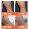 Zvoevo Vein Ease Microneedle Care Patch, 2026 New Vein Target Patches, Zvoevo Varicose Veins Treatment Patches for Legs, Natural Ingredients, for All Skin Types (1 Pack) view 4