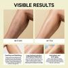 Vein Target Microneedle Patch, Vein Target Microneedle Patch, Professional Varicose Vein Treatment for Legs, Leg Treatment with Natural Ingredients for All Skin Types view 4