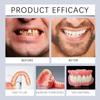 Silicone Reline Denture Set, Silicone Denture Set, Silicone Denture Kit, Soft Silicone Denture Reline Kit, Perfect Fit Denture Silicone Reline Kit (2pcs) view 4