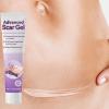 Scars Cream - Keloid Bump Cream for Evaluation | Resilient Build for Active Fade Wound Recovery Portable C Section Removal Keloid Bump Gel Face Body Skin Care Routine Utility view 3