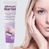 Scars Cream - Keloid Bump Cream for Evaluation | Resilient Build for Active Fade Wound Recovery Portable C Section Removal Keloid Bump Gel Face Body Skin Care Routine Utility view 4