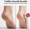 Foot Scraper for Dead Skin Stainless Steel Double Sided view 3