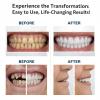 Advanced Customised Full Denture Set, Upper and Lower Denture Reline Kit, Snap On Dentures & Clip On Veneers, Comfortable Natural-Looking Teeth, for Men & Women (2pcs) view 3