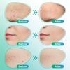 3 in 1 Microdarts Care Patch,Professional Silicone Scar Sheets,Silicone Scar Tape,Silicone Scar Strips for All Skin Types,Waterproof (2 Box) view 3