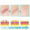3 in 1 Microdarts Care Patch,Professional Silicone Scar Sheets,Silicone Scar Tape,Silicone Scar Strips for All Skin Types,Waterproof (2 Box) view 4