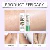 Intimate Hair Removal Cream,2026 New Multifunctional Hair Remover Cream,Gentle Soothing & Moisturizing,for Face Lip Bikini Line Inner Thighs Private Area view 3