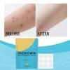Ingrown Hair Patch, 9PCS Gentle Patches Ingrown Hair Care, Pore Unclogging Stickers, For Men Women Underarms Legs Arms Beard Area Daily Overnight Home Salon view 3