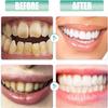 2026 New Neutrava Go Teeth Whitening Trays, Neutrava Whitening Trays, Mint Flavor, Soft and Comfortable, for Men & Women (2 Box) view 2
